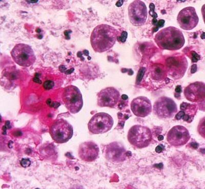 Yucatan-suspende-el-contacto-con-el-agua-en-seis-lagos-artificiales-de-Merida-por-presencia-de-Naegleria