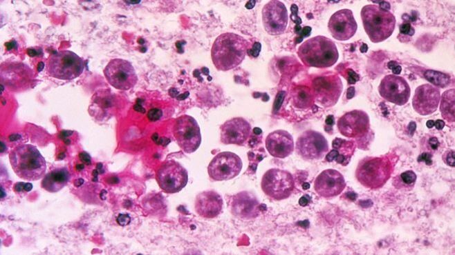 Yucatan-suspende-el-contacto-con-el-agua-en-seis-lagos-artificiales-de-Merida-por-presencia-de-Naegleria